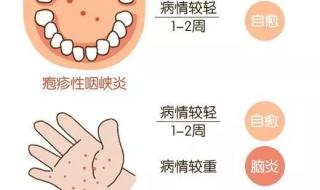 手足口病症状初期症状 手足口病症状初期症状